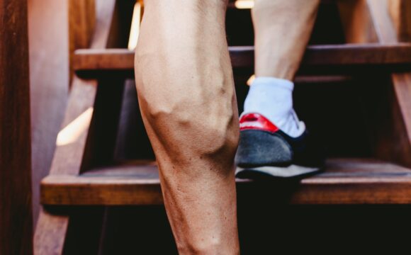 Large visible veins of calf muscles in a man's leg.